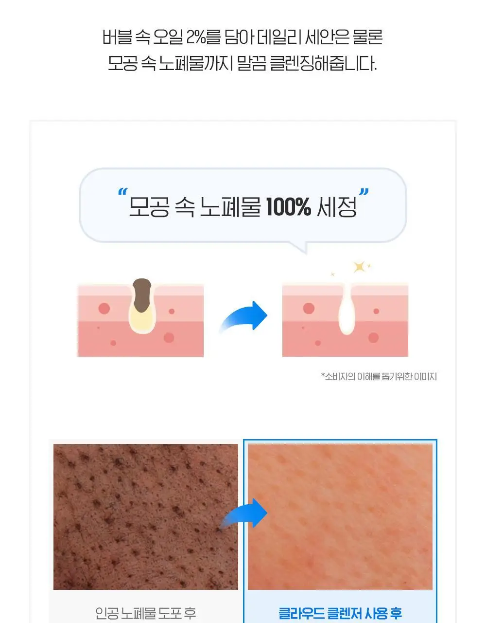 [버블폭탄] 빌리프 모이스춰라이징 밤 소프트 클라우드 클렌저 150ml 기획 (+소프트 클렌징 패드) 상세페이지 12